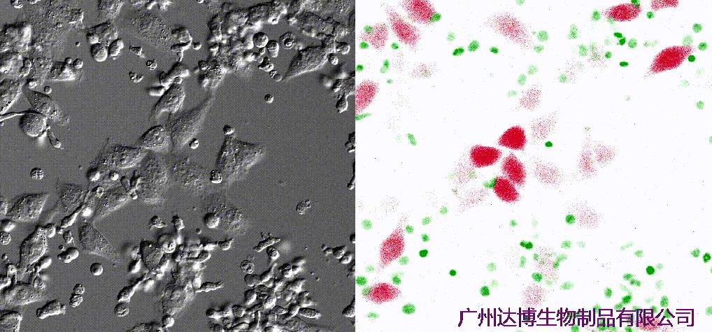 自體自然殺傷細(xì)胞注射液（E10H）