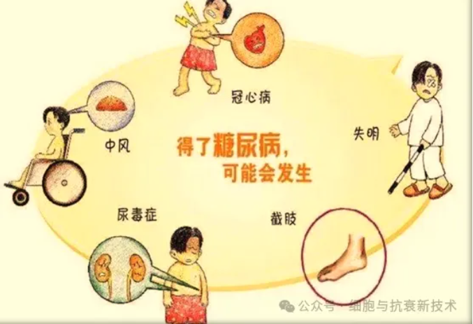 糖尿病并發(fā)癥